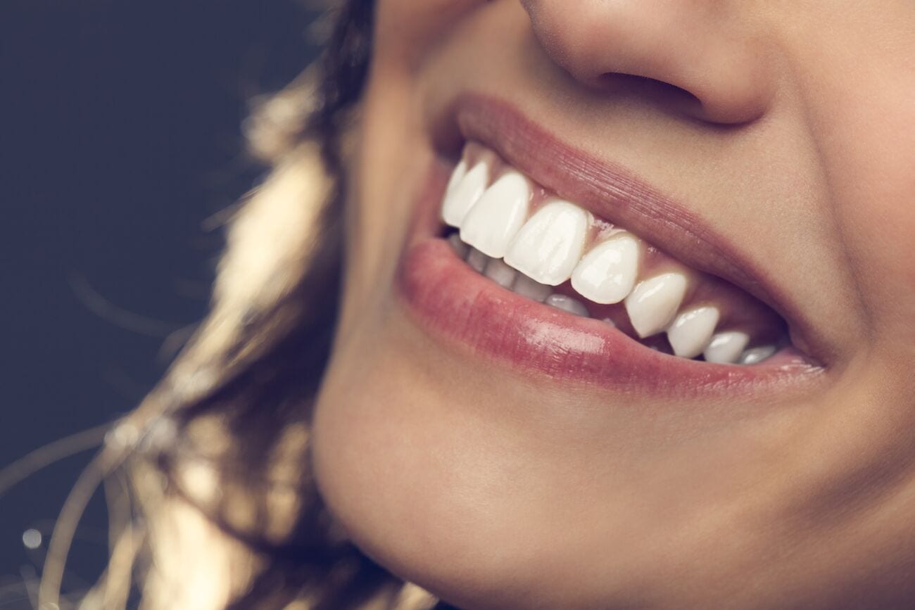 Professional Teeth Whitening in Dallas Texas