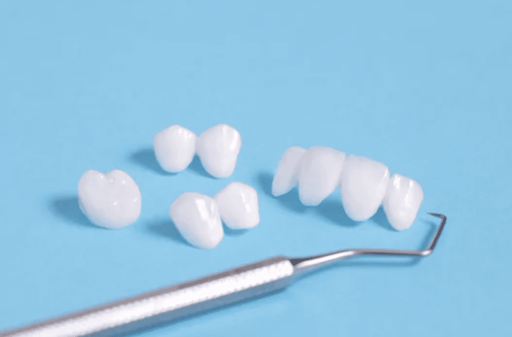 dental veneers sitting on blue background cosmetic dentistry dentist in Dallas Texas