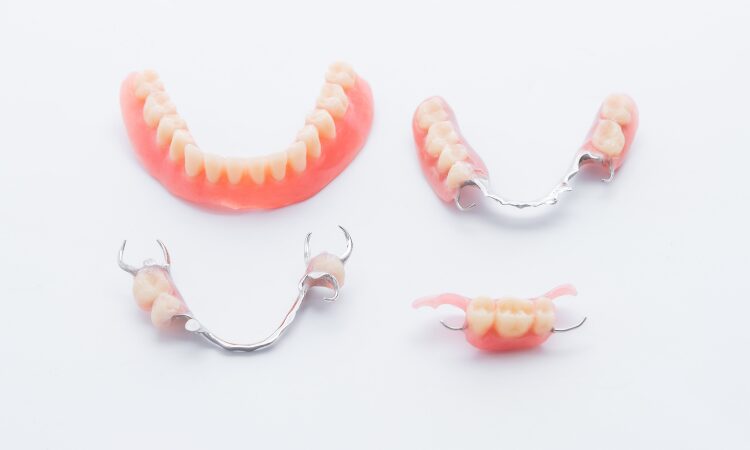 Dental professionals offer a range of solutions to restore function and aesthetics for patients with missing teeth.