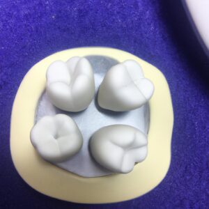 dental crowns for all ages